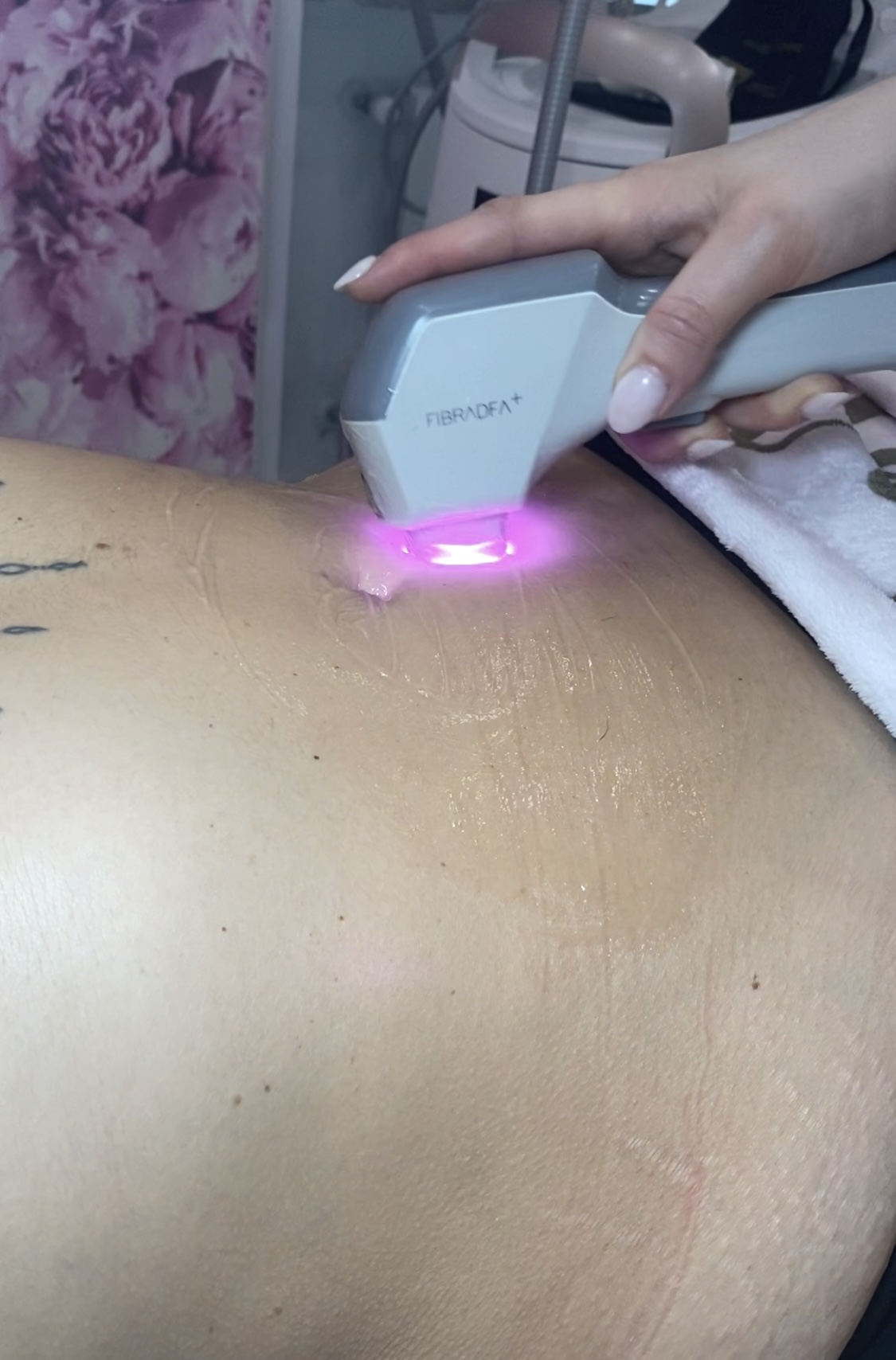 promo laser 9,90 - alassio